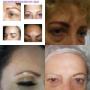 micro de cejas