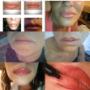 micro de labios