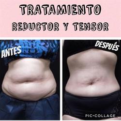 TRATAMIENTOS ESTETICOS FACIALES Y CORPORALES