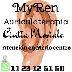 AURICULOTERAPIA MYREN CINTIA MORIALE