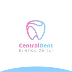 Central Dent