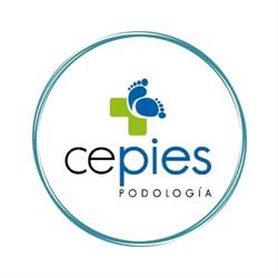Cepies