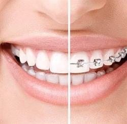 Bayres Dental Oeste