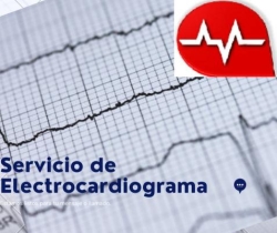 Electrocardiograma Lanús