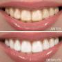 # 3