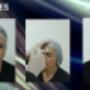 Botox de entrecejo - aplicacion