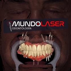 Mundolaser Dental