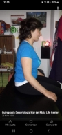Cifosis dorsal antes