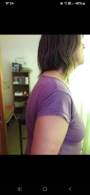 Corrección postural antes
