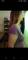 Corrección postural después de Quiropráxia