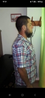 Después de Quiropráxia corrección rectificación cervical
