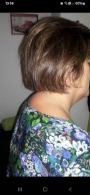Después de sesión de Quiropráxia cervical giba